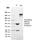 Prostate Specific Antigen (PSA) Antibody in SDS-PAGE (SDS-PAGE)