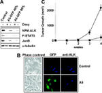 ALK Antibody in Immunocytochemistry (ICC/IF)