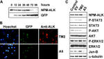 ALK Antibody in Immunocytochemistry (ICC/IF)