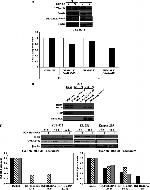 ALK Antibody in Western Blot (WB)