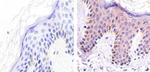 ALK Antibody in Immunohistochemistry (Paraffin) (IHC (P))