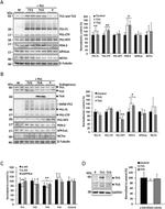 Ubiquilin 2 Antibody in Western Blot (WB)