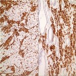 MUC4 Antibody in Immunohistochemistry (IHC)