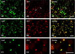 Connexin 43 Antibody in Immunohistochemistry (IHC)