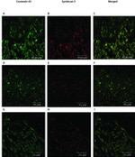 Connexin 43 Antibody in Immunohistochemistry (IHC)