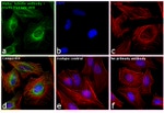 Mouse IgG (H+L) Secondary Antibody in Immunocytochemistry (ICC/IF)