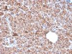 Interleukin-1 alpha (IL-1 alpha) Antibody in Immunohistochemistry (Paraffin) (IHC (P))