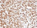 Interleukin-1beta (IL-1beta) Antibody in Immunohistochemistry (Paraffin) (IHC (P))