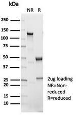 Interleukin-1 beta (IL-1 beta) Antibody in SDS-PAGE (SDS-PAGE)