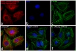 Rabbit IgG (H+L) Cross-Adsorbed Secondary Antibody in Immunocytochemistry (ICC/IF)