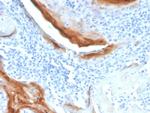 IL1RN/IL-1RN/IL1RA (Interleukin-1RA) Antibody in Immunohistochemistry (Paraffin) (IHC (P))