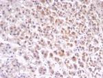 IL1RN/IL-1RN/IL1RA (Interleukin-1RA) Antibody in Immunohistochemistry (Paraffin) (IHC (P))