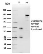 Interleukin-2 (IL-2) Antibody in Immunoelectrophoresis (IE)