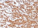 Interleukin-2 (IL-2) Antibody in Immunohistochemistry (Paraffin) (IHC (P))