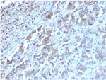 Interleukin-2 (IL-2) Antibody in Immunohistochemistry (Paraffin) (IHC (P))