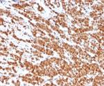 Interleukin-2 (IL-2) Antibody in Immunohistochemistry (Paraffin) (IHC (P))