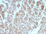 Interleukin-2 (IL-2) Antibody in Immunohistochemistry (Paraffin) (IHC (P))