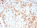 Interleukin-2 (IL-2) Antibody in Immunohistochemistry (Paraffin) (IHC (P))