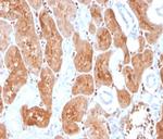 Interleukin-2 (IL-2) Antibody in Immunohistochemistry (Paraffin) (IHC (P))