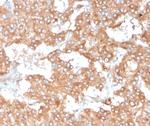 Interleukin-2 (IL-2) Antibody in Immunohistochemistry (Paraffin) (IHC (P))