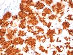 Interleukin-2 (IL-2) Antibody in Immunohistochemistry (Paraffin) (IHC (P))