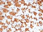 Interleukin-2 (IL-2) Antibody in Immunohistochemistry (Paraffin) (IHC (P))