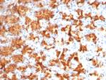 Interleukin-2 (IL-2) Antibody in Immunohistochemistry (Paraffin) (IHC (P))