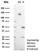 Interleukin-2 (IL-2) Antibody in SDS-PAGE (SDS-PAGE)