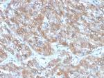 Interleukin-2 (IL-2) Antibody in Immunohistochemistry (Paraffin) (IHC (P))