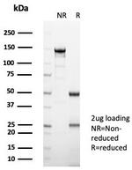 Interleukin-2 (IL-2) Antibody in SDS-PAGE (SDS-PAGE)