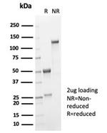 Interleukin-2 (IL-2) Antibody in SDS-PAGE (SDS-PAGE)