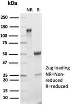 Interleukin-2 (IL-2) Antibody in Immunoelectrophoresis (IE)