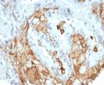 Interleukin-2 (IL-2) Antibody in Immunohistochemistry (Paraffin) (IHC (P))