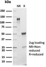 Interleukin-2 (IL-2) Antibody in SDS-PAGE (SDS-PAGE)