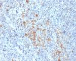 CD25/IL2RA (Activated Lymphocyte Marker) Antibody in Immunohistochemistry (Paraffin) (IHC (P))