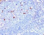 CD25/IL2RA (Activated Lymphocyte Marker) Antibody in Immunohistochemistry (Paraffin) (IHC (P))