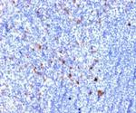 CD25/IL2RA (Activated Lymphocyte Marker) Antibody in Immunohistochemistry (Paraffin) (IHC (P))