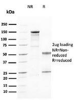 CD25/IL2RA (Activated Lymphocyte Marker) Antibody in SDS-PAGE (SDS-PAGE)