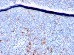 CD25/IL2RA (Activated Lymphocyte Marker) Antibody in Immunohistochemistry (Paraffin) (IHC (P))