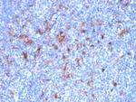 CD25/IL2RA (Activated Lymphocyte Marker) Antibody in Immunohistochemistry (Paraffin) (IHC (P))