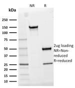 CD25/IL2RA (Activated Lymphocyte Marker) Antibody in SDS-PAGE (SDS-PAGE)