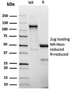 CD25/IL2RA (Activated Lymphocyte Marker) Antibody in SDS-PAGE (SDS-PAGE)