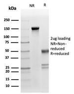 Fas Ligand (FASLG) Antibody in Immunoelectrophoresis (IE)