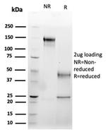 Fas Ligand (FASLG) Antibody in Immunoelectrophoresis (IE)