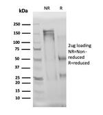 Interleukin-3 (IL-3) Antibody in Immunoelectrophoresis (IE)