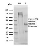 Interleukin-3 (IL-3) Antibody in SDS-PAGE (SDS-PAGE)