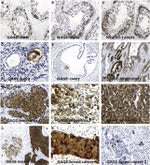 NY-ESO-1 Antibody in Immunohistochemistry (Paraffin) (IHC (P))