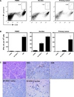 NY-ESO-1 Antibody in Immunohistochemistry (IHC)