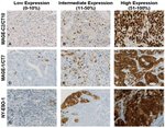 NY-ESO-1 Antibody in Immunohistochemistry (IHC)