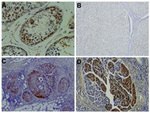 NY-ESO-1 Antibody in Immunohistochemistry (IHC)